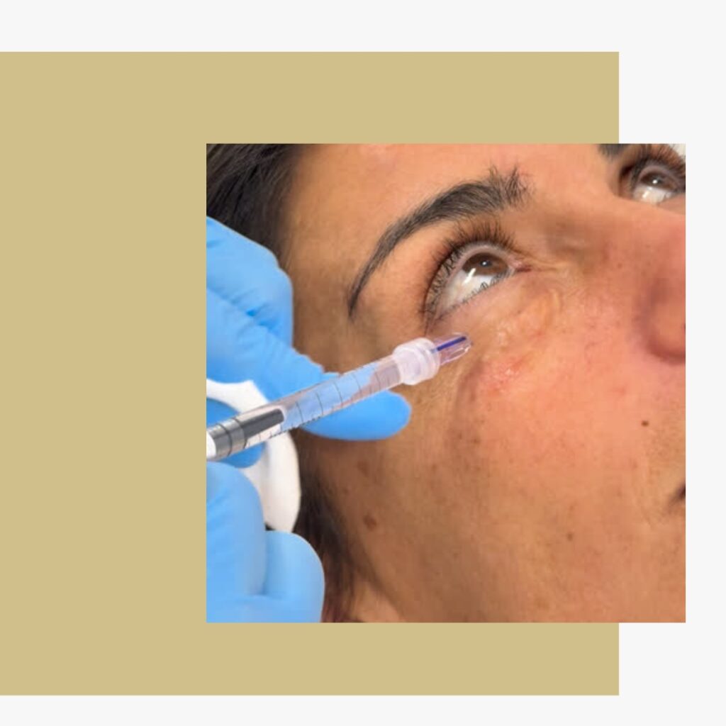 O que é o Microagulhamento ou Microneedling